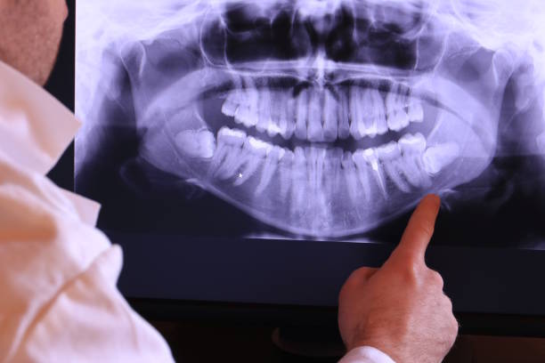 Best Emergency Dental Care for Broken or Chipped Teeth in Bell, CA
