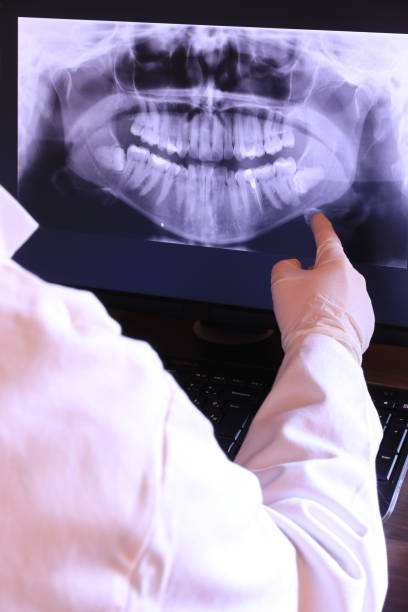 Best Emergency Wisdom Teeth Removal in Bell, CA